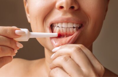 定期的なクリーニングはなぜ必要なの？【歯周病を予防する第一歩】のアイキャッチ画像