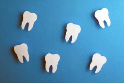 歯の種類と寿命知っていますか？【永久歯と乳歯の寿命について】のアイキャッチ画像