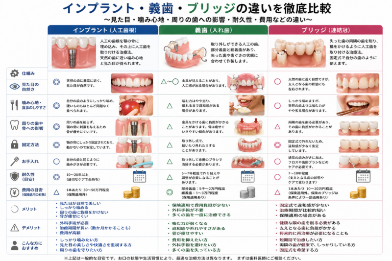 【歯を失ったあとの選択に悩んでいる患者様へ】のアイキャッチ画像