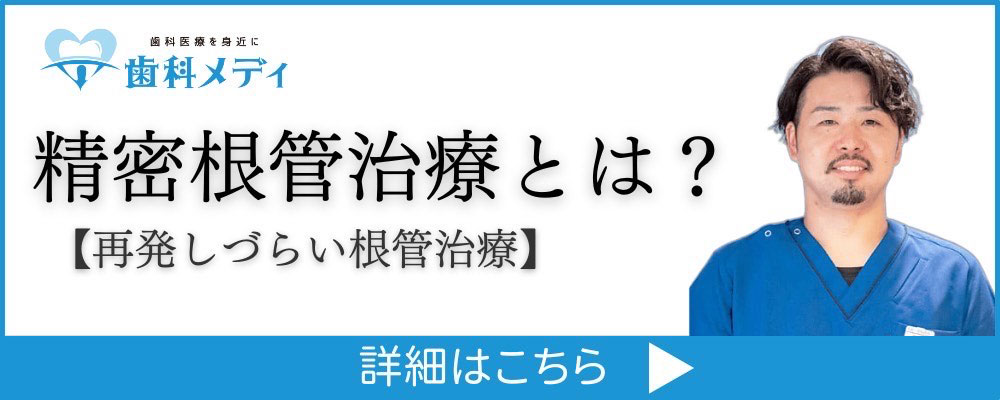 精密根管治療とは？【再発しづらい根管治療】